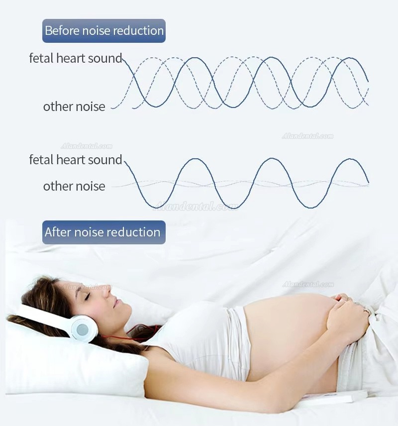 CONTEC 10A(LED) Baby Sound Monitor Pocket Fetal Doppler